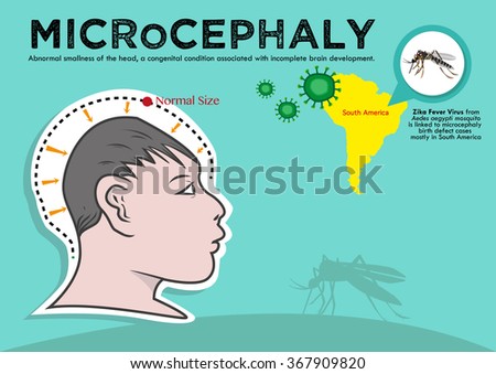 Microcephaly or Abnormal Smallness of the Head Concept. The Zika Fever Virus is linked to microcephaly birth defect cases from pregnant women bitten by Aedes aegypti mosquitoes. Editable Clip Art