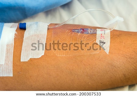 IV needle on patient arm for medicine injection