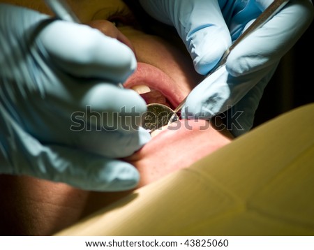 A dentist checks the backs of the teeth of a patient in his office. Closeup of the doctor\'s hands holding a mirror and a probe in her mouth