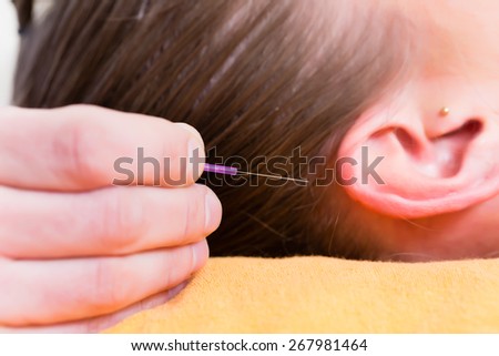 Alternative therapist pinching acupuncture needle in ear of woman