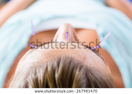 Woman at acupuncture with needles in face receiving alternative treatment