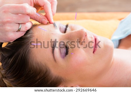 Therapist setting acupuncture needles on woman in course of acupuncture treatment