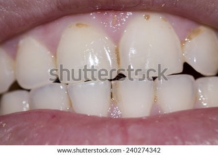 Periodic dental examination to have a healthy mouth and teeth.