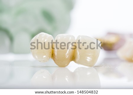 Macro of prosthetic teeth on a white background.