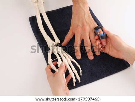 Hand surgeon with skeleton hand at patient