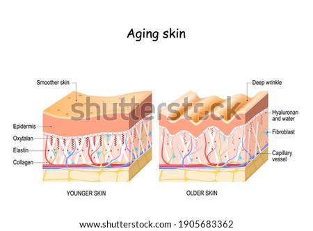 Aging skin. comparison and difference between older and younger skin. Close-up of fibroblast, collagen, elastin, and Oxytalan fibers, Hyaluronic acid. skin changes 