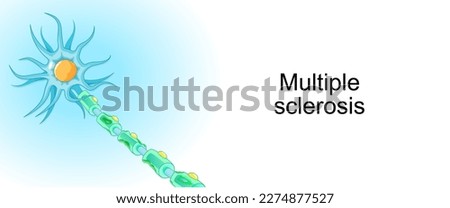 Multiple sclerosis. demyelinating disease. autoimmune disease. Vector illustration for poster or banner about World Multiple Sclerosis Day. 