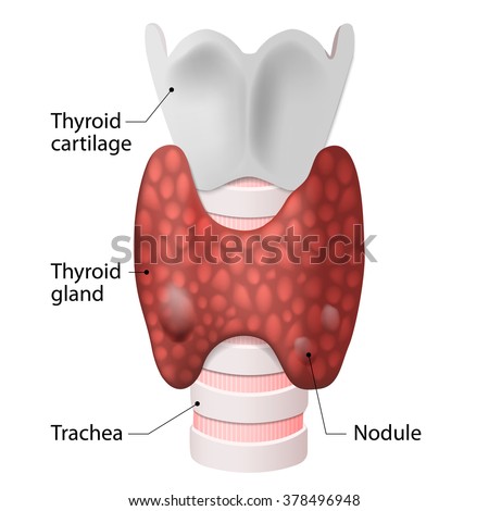 Thyroid Nodules And Goiters. Anatomy Of The Thyroid Gland (Included ...