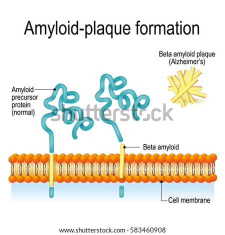 Cell membrane with Amyloid precursor protein (APP) and beta amyloid. Amyloid-plaque formation. Alzheimer's disease