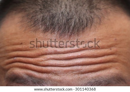 close-up on wrinkled forehead