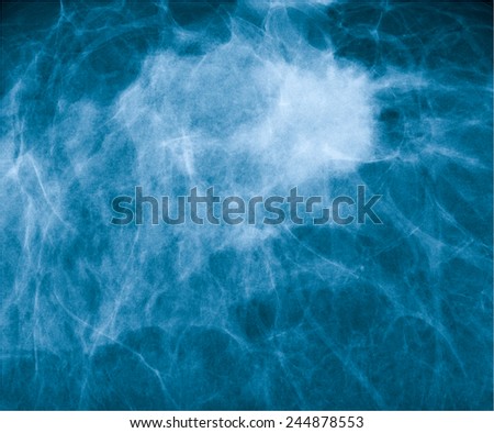 magnetic resonance image (MRI) of the breast scan, beatufull background image for desktop