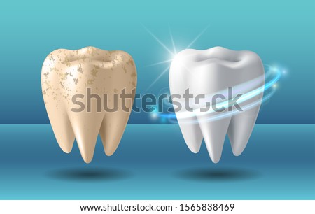 Teeth whitening 3d concept. Comparison of clean and dirty tooth before and after whitening treatment. Teeth whitening procedure, dental health and oral hygiene poster for dentistry design