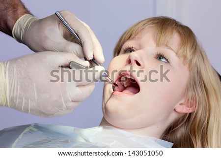 Woman having teeth examined by the Dental-Surgeon. Close-up of a beautiful blond woman having the teeth examined by a Dental-Surgeon