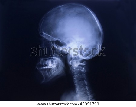 Human skull - showing X-ray building of skeleton of man and some internal organs