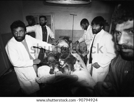 CHARIKAR, AFGHANISTAN - OCT 23: Doctors prepare to amputate the bomb shattered leg of a Northern Alliance soldier in a hospital in Charikar, Afghanistan, on Wednesday, October 23, 1996.