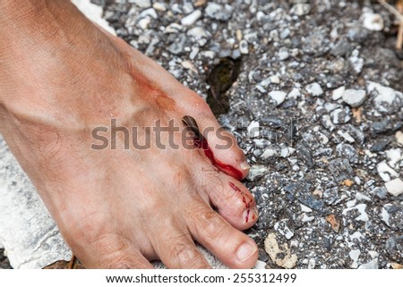 tropical leech biting human foot on street beside asian rainforest