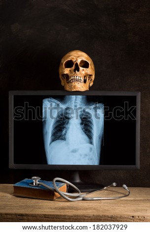 Still life photography, human skull with X-ray image of human spine and  breastbone in monitor