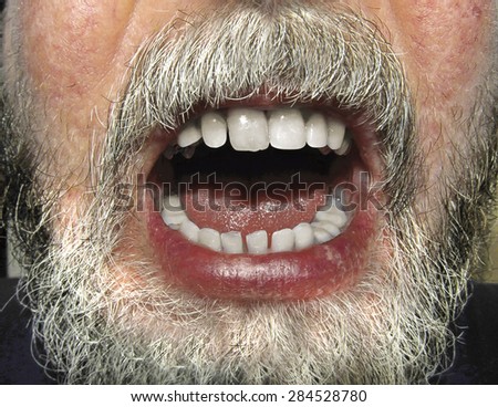 A close up of a male face with beard and open mouth baring teeth.