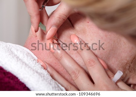 Beautician removed at a customer in a beauty salon skin blemishes