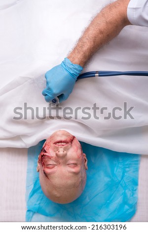 Portrait of the woman injured in the car accident lying on the operation table covered with the white material is examined by the doctor. Top view