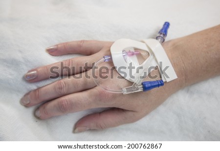 IV needle in a patients hand getting ready for surgery