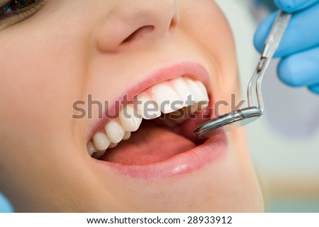 Close-up of patient?s open mouth before oral inspection with mirror near by