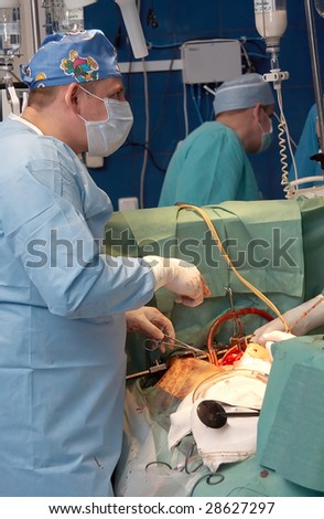The command of surgeons spends operation on the open heart