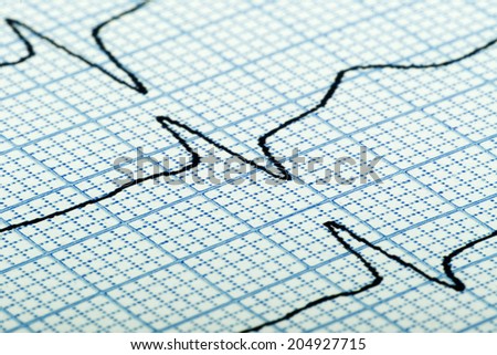 cardiogram (aka electrocardiogram, aka ECG) of heart beat on blue grid paper