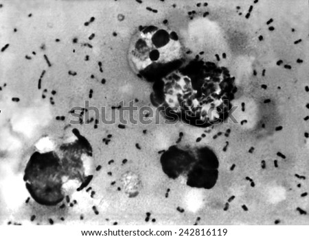 Yersinia pestis bacteria which caused Bubonic Plague. 1965. Stock fotó © 
