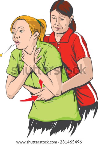 Heimlich maneuver performing