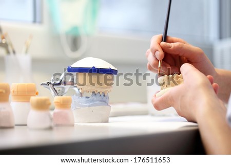 dental dentist objects implants