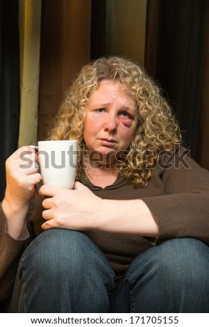 a middle aged woman with a black eye looks sad and introspective.