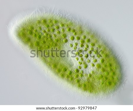 Paramecium bursaria with symbiotic algea differential interference contrast DIC focus to cilia, symbiotic algea