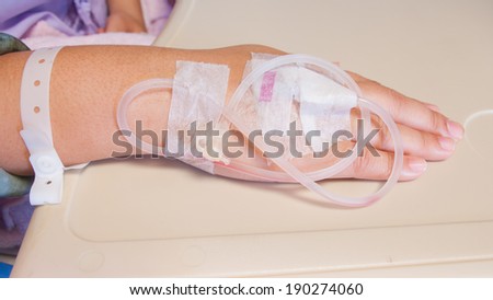Close up  patients hand after remove iv drip