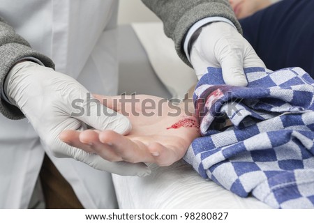 Doctor removing a  tea towel, used as temporary bandage from a bleeding cut on a patient\'s hand