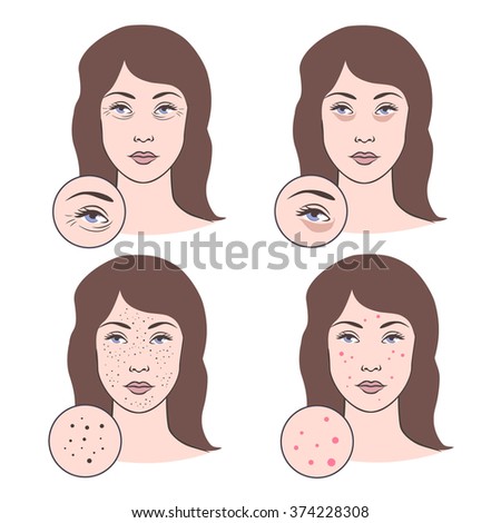 Vector Illustration Of Skin Problems: Wrinkles, Acne, Pimples ...