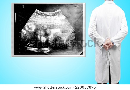 rear view image of doctors with stethoscope in a hospital pose arms crossed behind back looking at virtual screen diagnosis X-ray film of unborn child concept for medical