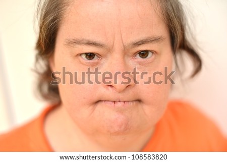 Old Woman With Down Syndrome Stock Photo 108583820 : Shutterstock