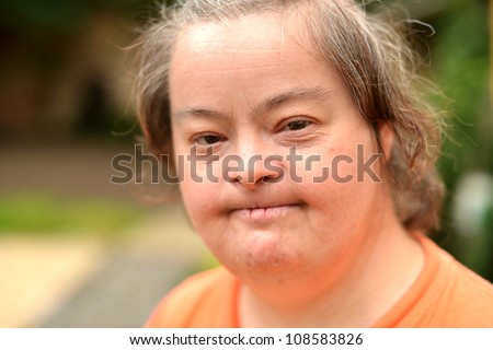 old woman with down syndrome