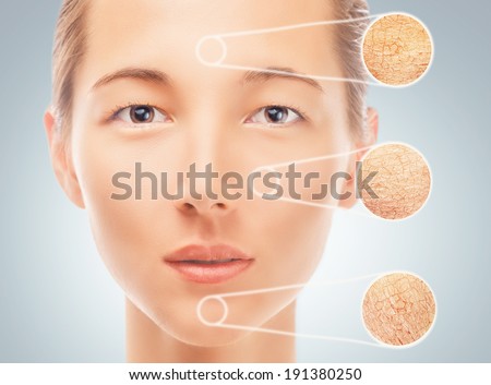 Portrait of young woman with parts of dry skin, concept of skincare