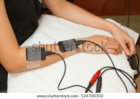 Electrical stimulation forearm ,physical therapist helping woman with electrical stimulator for increase muscle strength and release pain