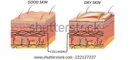 Skin Anatomy Diagram - Comparation Good Skin And Dry. Illustration Of ...