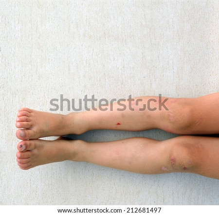 young boy injured legs on ceramic background with copy space
