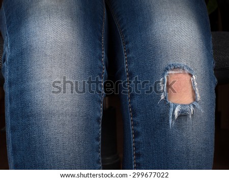 Close up view on boy or girl legs with jeans torn denim and body skin in hole on knee