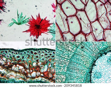 Light photomicrograph of apple fruit (top left), red onion cells (top right) and pine tree wood section (bottom) seen through a microscope