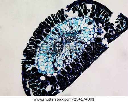 Light photomicrograph of Pine leaf cross section seen through microscope