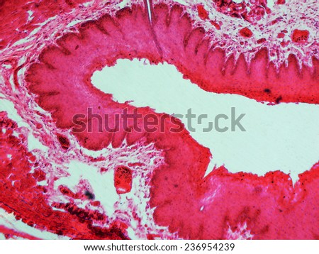 Light photomicrograph of stratified flat epithelium section seen through a microscope