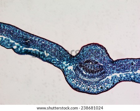 Light photomicrograph of Leaf transversal section seen through microscope