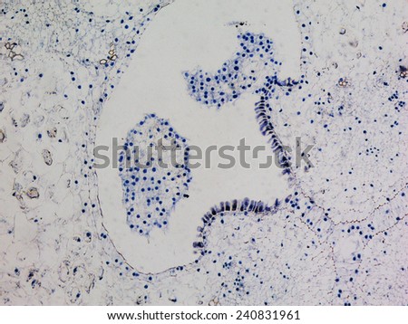 Light photomicrograph of Lily ovary cross section seen through microscope