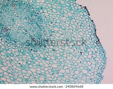 Light photomicrograph of Vicia Faba young root cross section seen through microscope